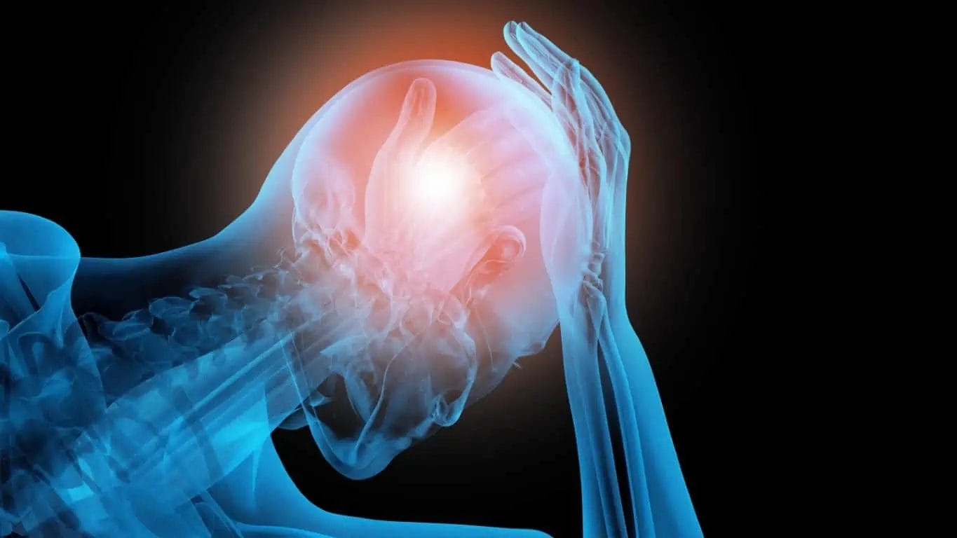 An Illustration of a human with high activity of brain leading to Migraines and and Vertigo called Vestibular Migraine